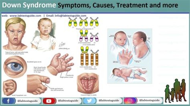 Analyzing The Truth: George Clooney And The Rumors Of A Down Syndrome Child