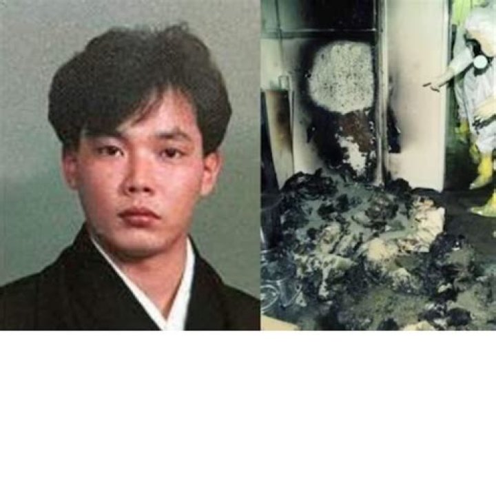 Beware Of Graphic Content: Grisly Photos Of Hisashi Ouchi's Radiation Burns