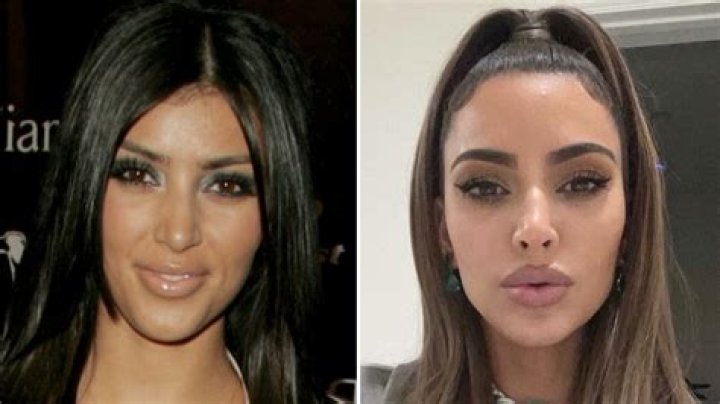 Kim Kardashian Before Surgery: The Transformation Uncovered