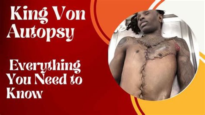 King Von Autopsy Results: A Shocking Revelation