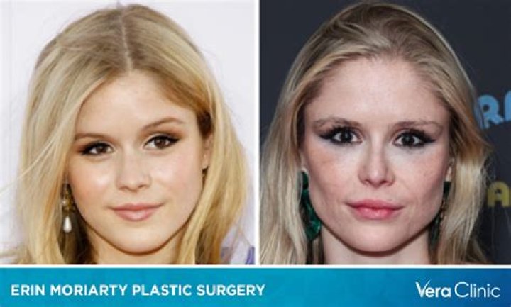 The Truth Behind Alanna Panday's Plastic Surgery Rumors