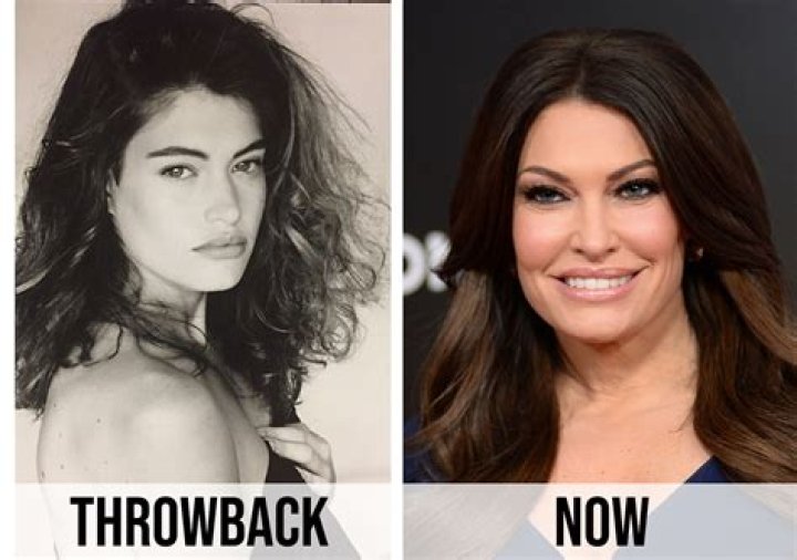 Unveiling Kimberly Guilfoyle's Plastic Surgery Transformation: Before And After Photos