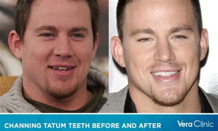 Unveiling The Truth: Channing Tatum's Twin Brother Mystery Solved